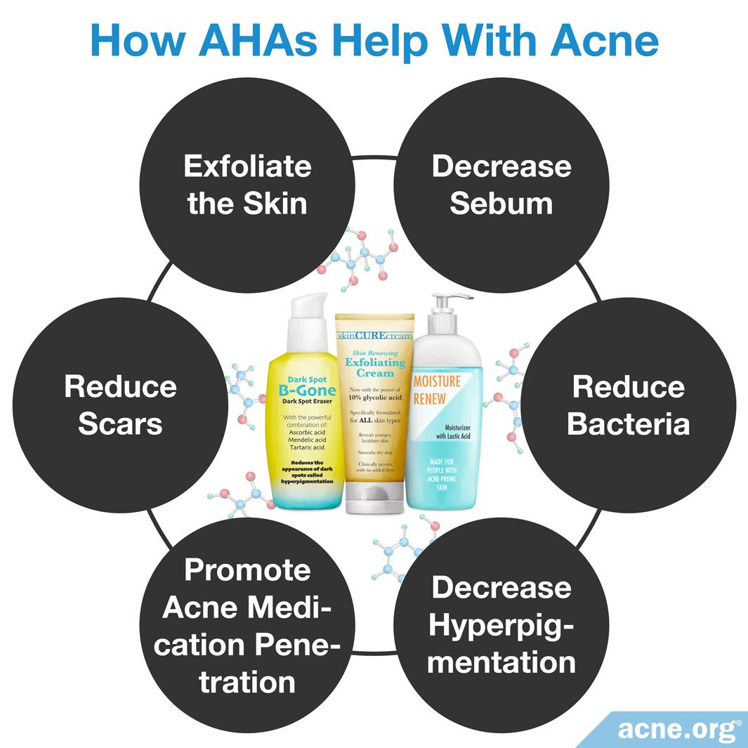 Alpha Hydroxy Acid Acne Scar Treatment