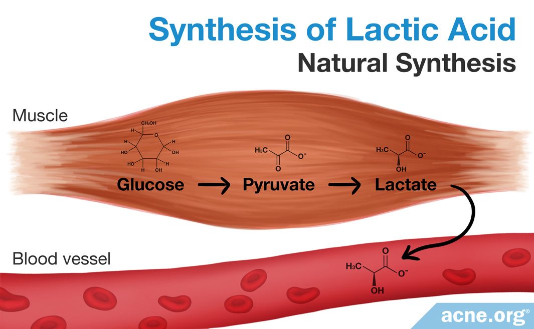 what-are-the-chemical-structure-of-lactic-acid-and-lactate-acne