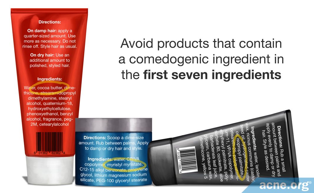 Some Leavein Hair Products May Cause Acne