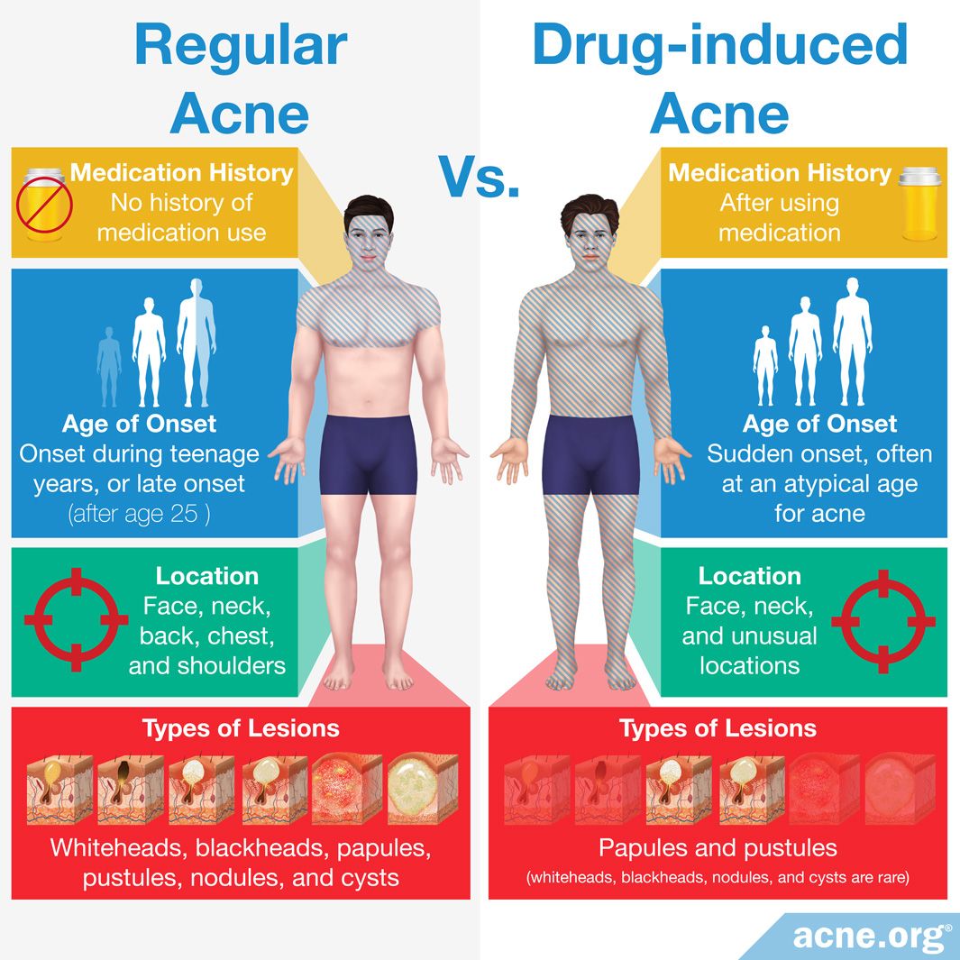 What Medications Can Cause Acne? - Acne.org