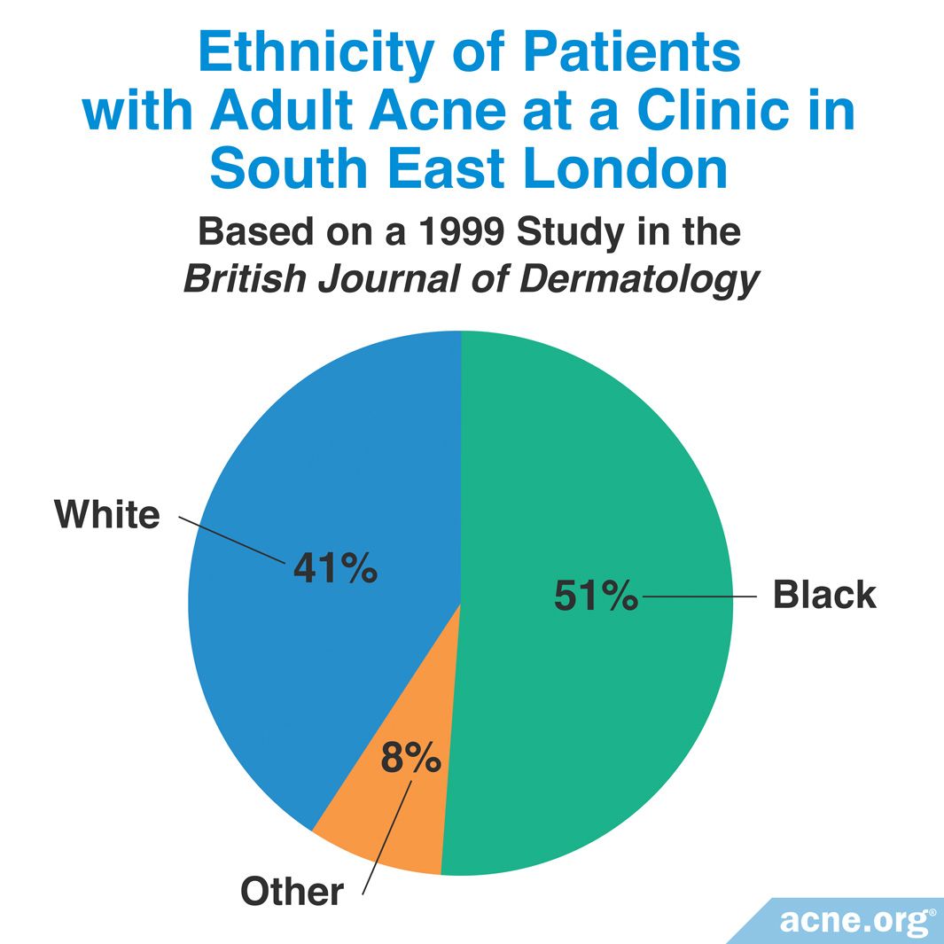 what-ethnicity-has-the-most-adult-acne-acne