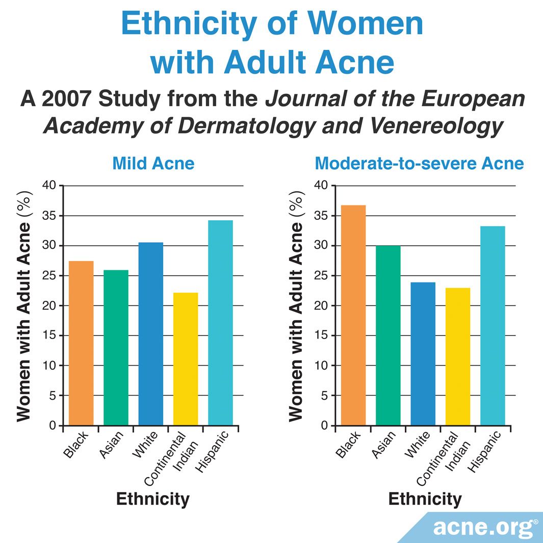 what-ethnicity-has-the-most-adult-acne-acne