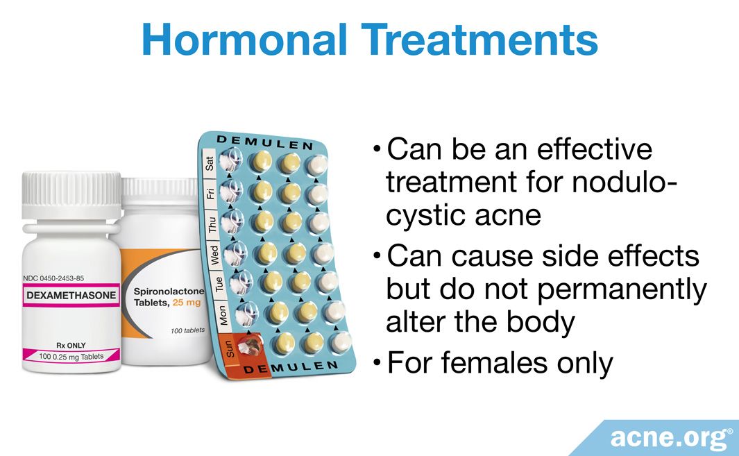 what-s-the-best-treatment-for-cystic-acne-acne