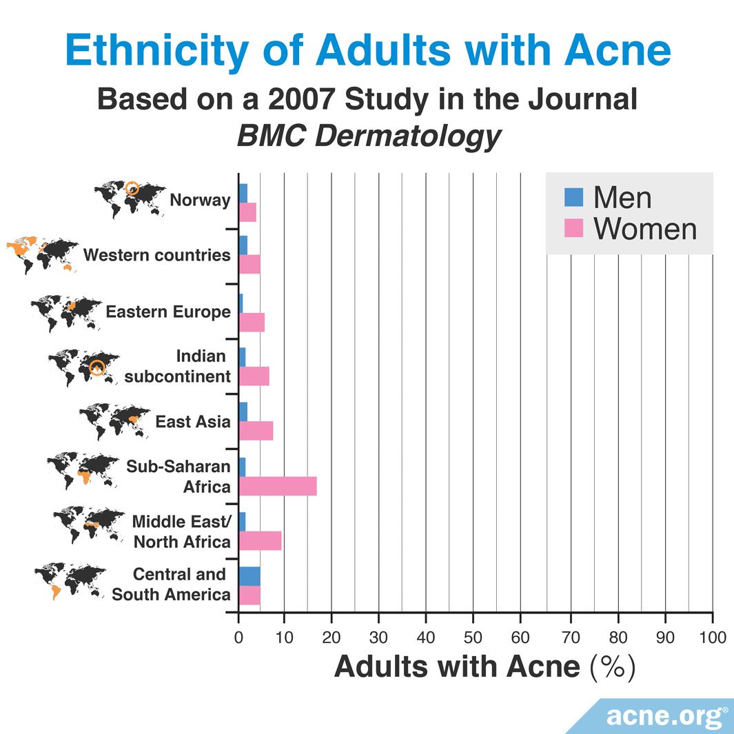 what-ethnicity-has-the-most-adult-acne-acne