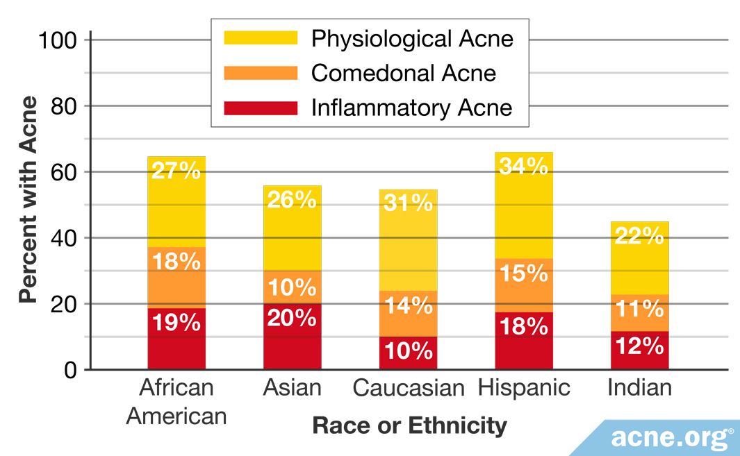 Indian Skin and Acne - Acne.org