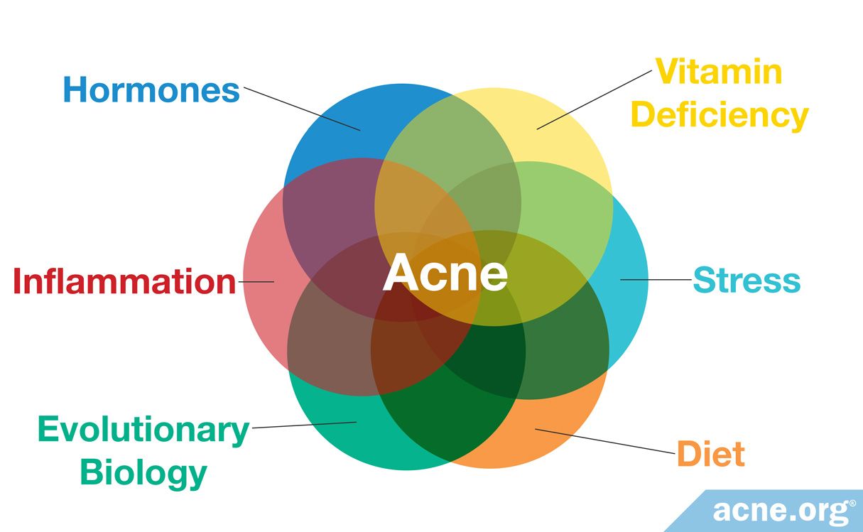 What Causes Acne? - Acne.org