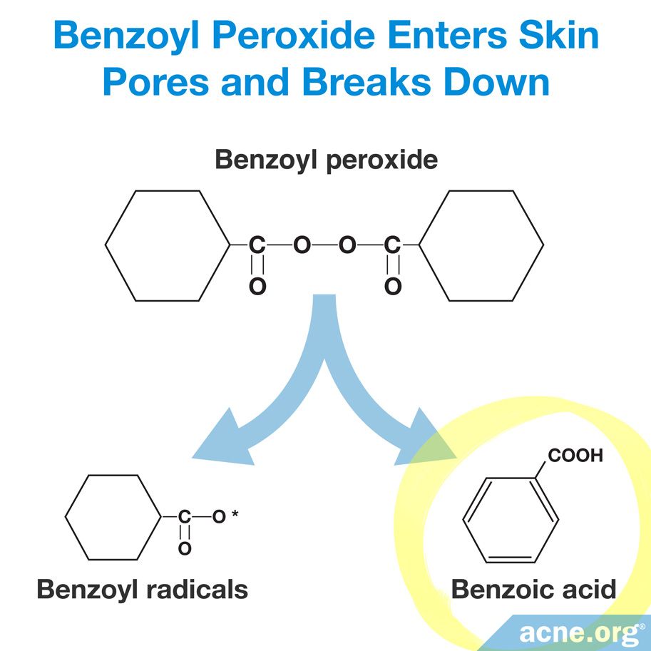 what-is-benzoic-acid-and-can-it-help-clear-acne-acne
