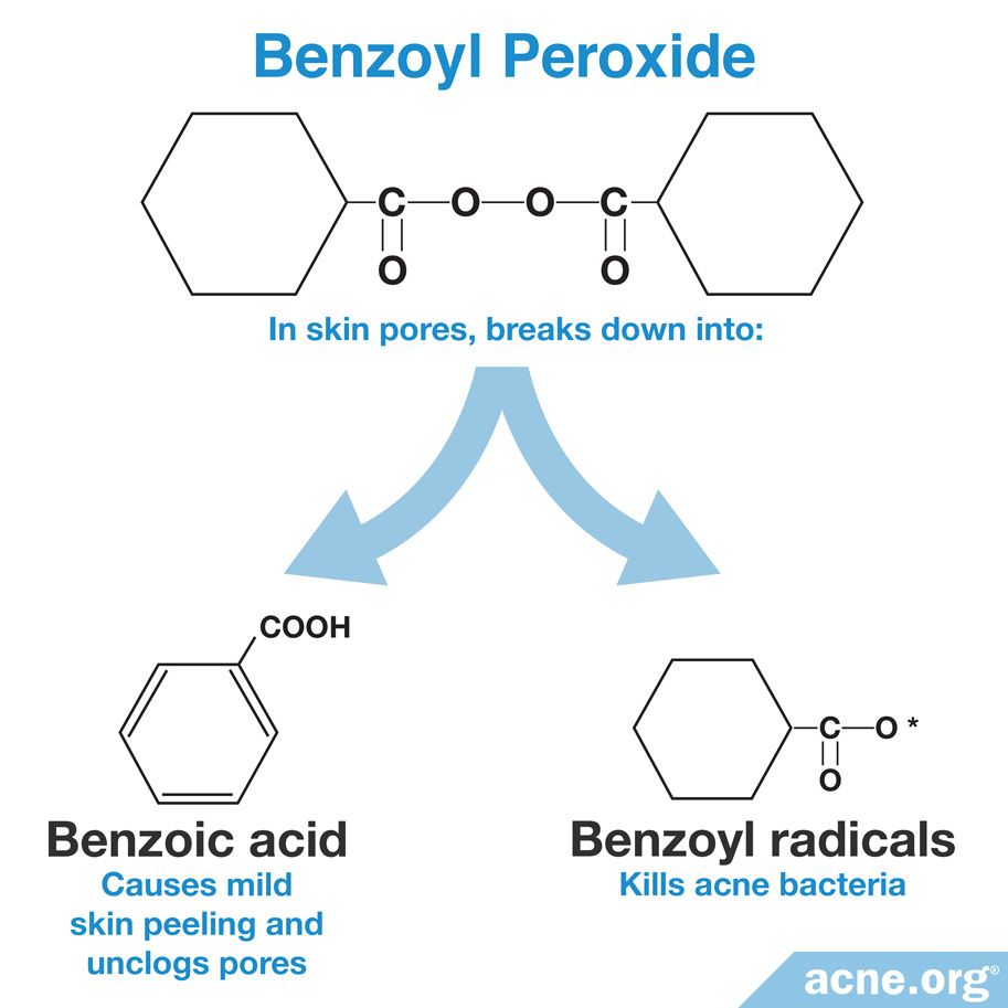 Is Benzoyl Peroxide Safe? - Acne.org