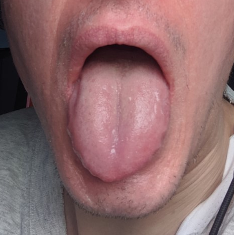 tounge.png.1d99dbbf5773e576c0db203f39657b39.png