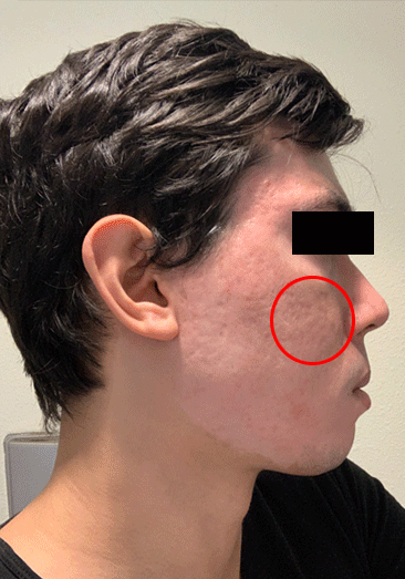 right-scarring.png.b06af72a6accce4464d94b9cef3c9239.png