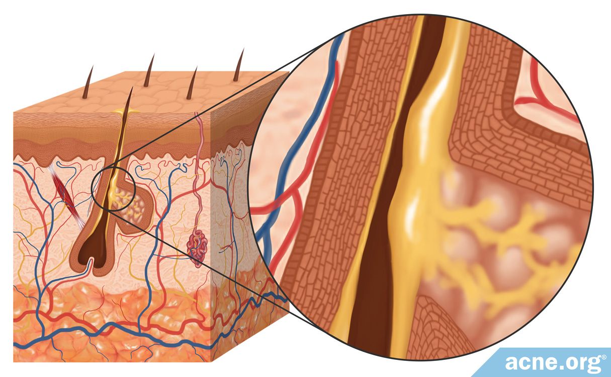 what-is-sebum-and-what-is-its-purpose-acne