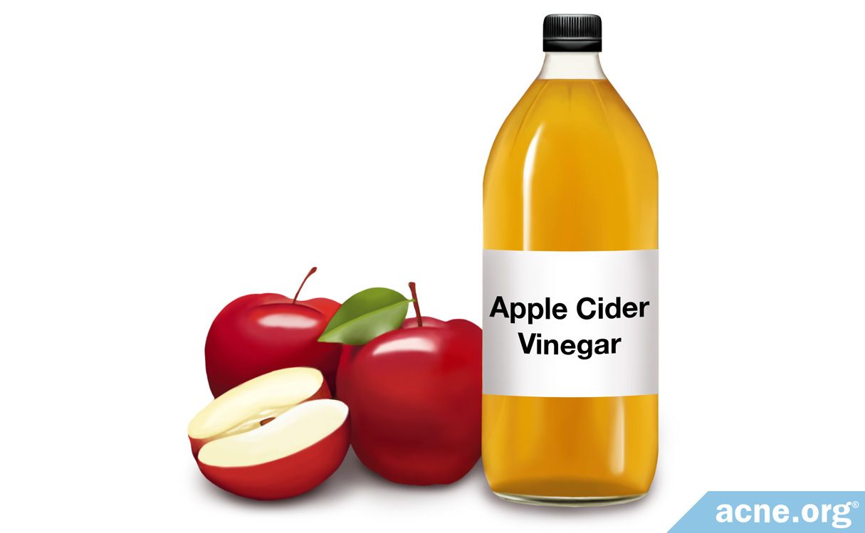 Topical Apple Cider Vinegar And Acne