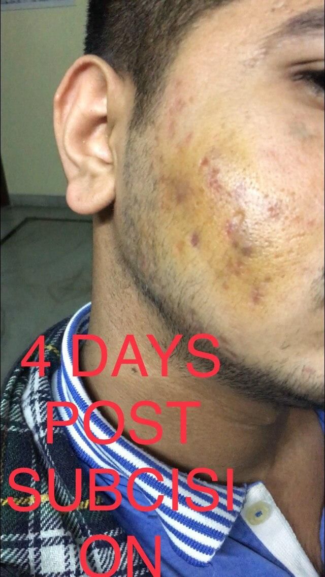 1456451129_4DAYS.jpg.49585e087aa13e7b9884342e0c1513b2.jpg