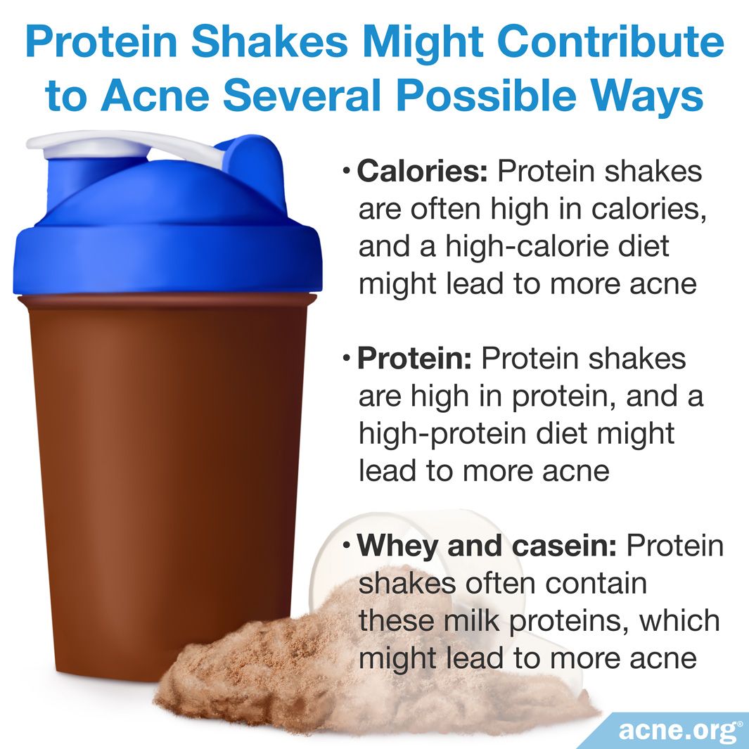 can-protein-shakes-cause-acne-acne