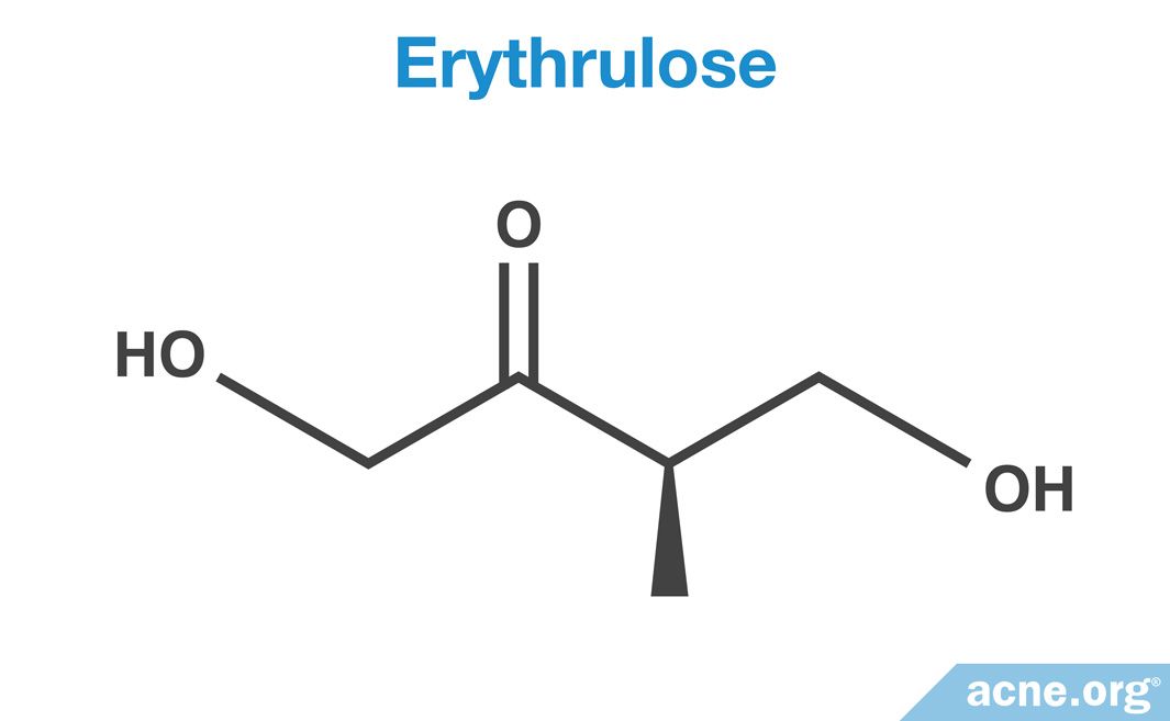 Are Selftanners Safe for Acneprone Skin?