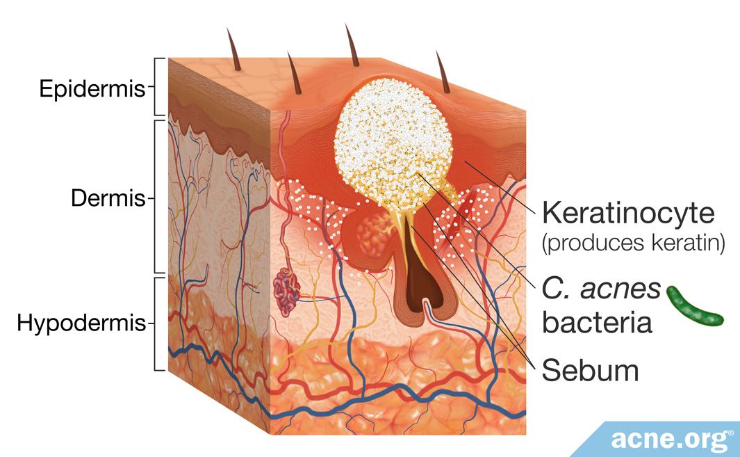 what-is-sebum-and-what-is-its-purpose-acne