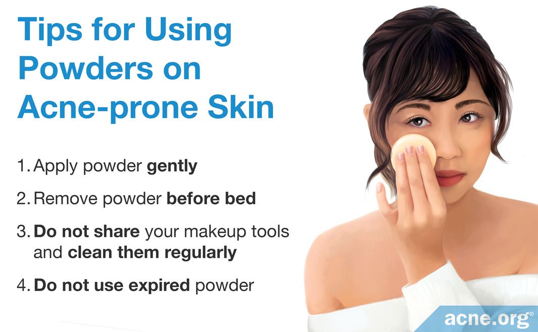 For face best skin prone the powder what acne is Top 10