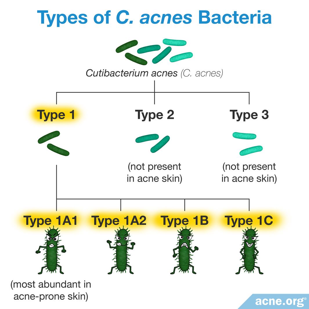 Do Different Strains of Bacteria Affect Acne Differently?