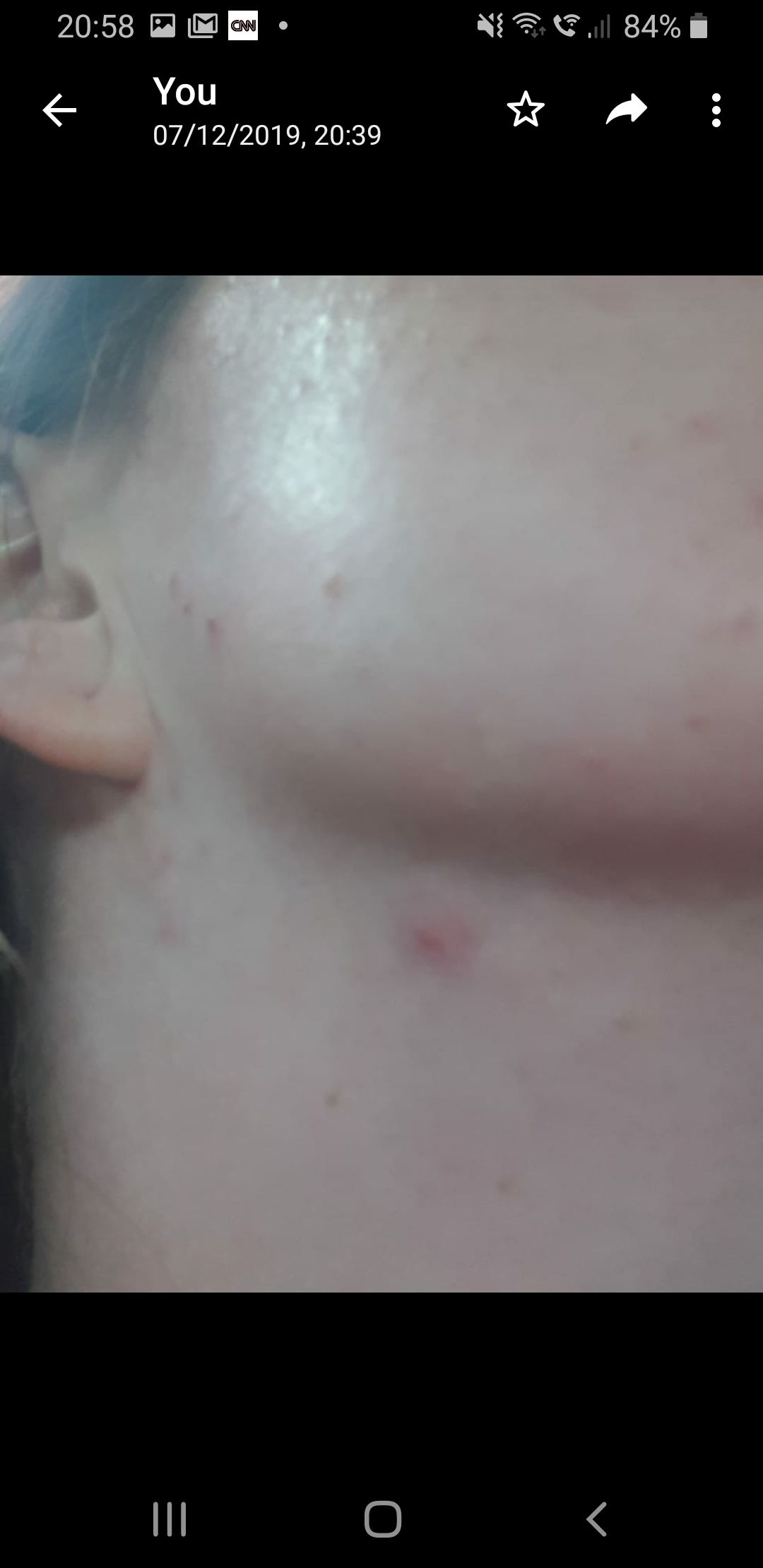 Weleda Skin Food Helped Get Me Through Accutane