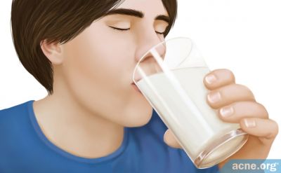 The Tenuous Relationship Between Dairy and Acne