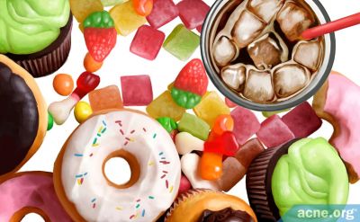 Do Sugary Foods and Drinks Cause Acne?