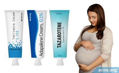 Is It Safe to Use Topical Retinoid Medications (Tretinoin, Adapalene, Tazarotene) When Pregnant?
