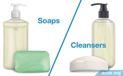 Soaps or Cleansers: Which Is Better for Acne-prone Skin?