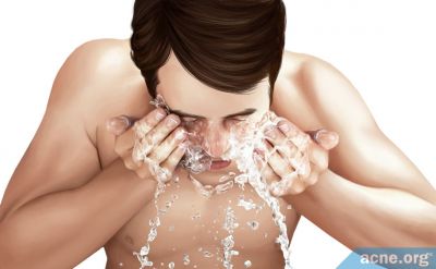 Does Washing the Skin Help or Hurt Acne?