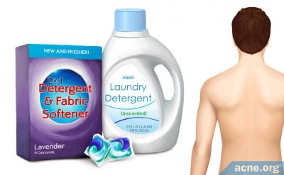 Can Laundry Detergent Cause Body Acne?