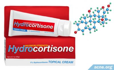 Can Topical Hydrocortisone Help with Acne?
