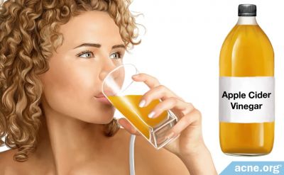 Can Drinking Apple Cider Vinegar Help with Acne?