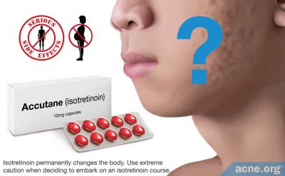 Does Isotretinoin Help with Acne Scars?