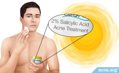 Does Salicylic Acid Make Your Skin More Sensitive to the Sun?