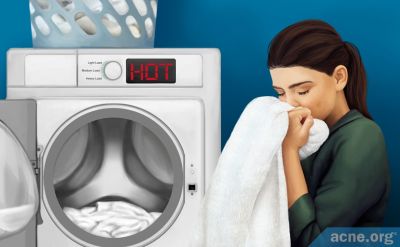 How Often Should an Acne-prone Person Wash Their Towel?