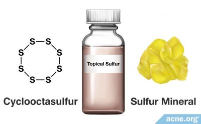 Sulfur for Acne