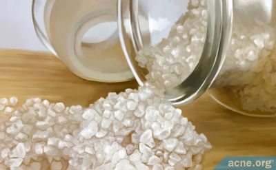 Can Topical Epsom Salt Treat Acne?