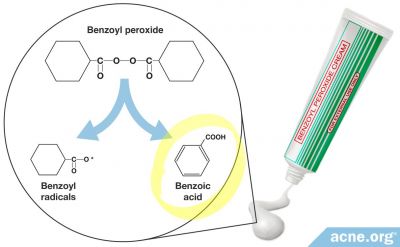 What is Benzoic Acid and Can it Help Clear Acne?
