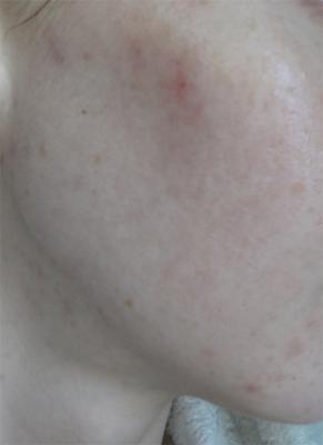 post-185908-0-55663100-1358321291_thumb.