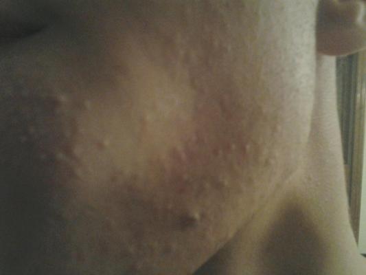 post-196141-0-15262300-1358383405_thumb.