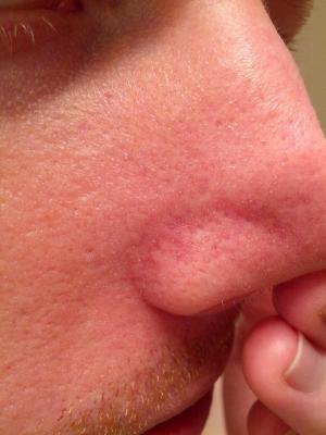post-198459-0-19915100-1359667634_thumb.