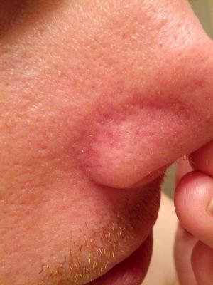 post-198459-0-99469300-1359667726_thumb.