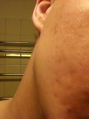 post-210214-0-29164500-1370370074_thumb.