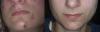 post-218655-0-65672600-1392541042_thumb.