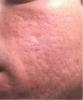 post-27682-1140156697_thumb.jpg
