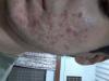 post-361715-0-95755300-1384791076_thumb.