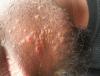 post-378247-0-23132200-1392950880_thumb.