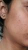 post-381709-0-82601300-1399655746_thumb.