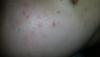 post-386865-0-73981900-1396189335_thumb.