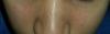post-413276-0-55038900-1406936365_thumb.