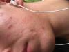 post-421877-0-20247400-1422927123_thumb.